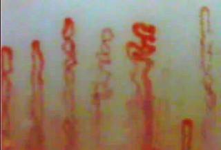 毛細血管のパターン